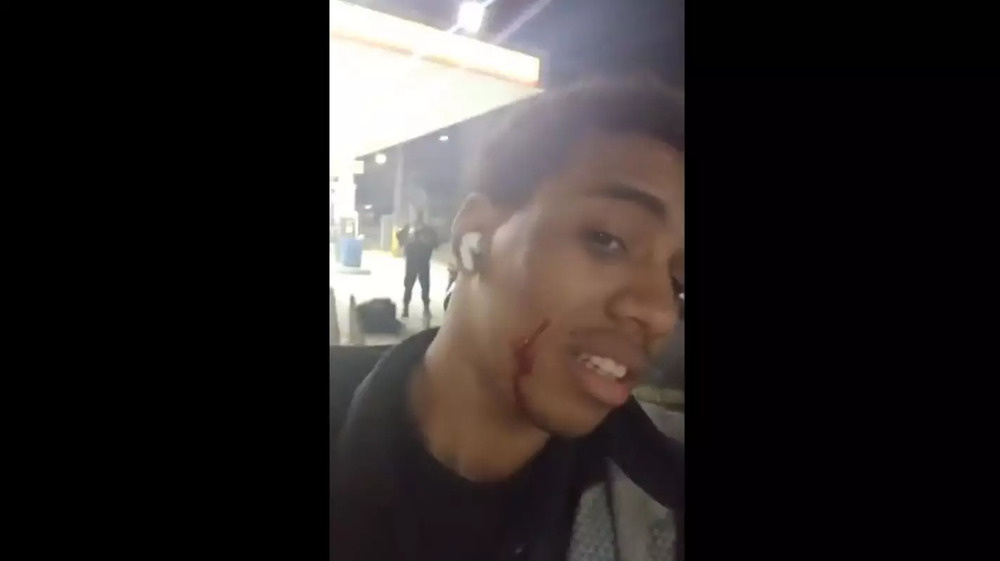 VÍDEO: motoboy diz ter levado tiro no rosto ao fazer entrega em comunidade no Rio